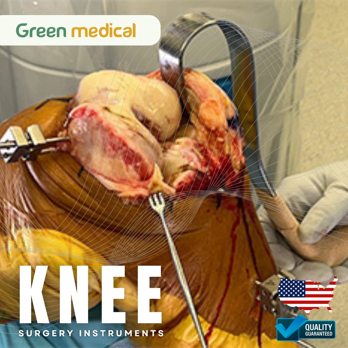 Lonner Swan Lateral Knee Retractor Orthopedic Surgical Instrument Stainless