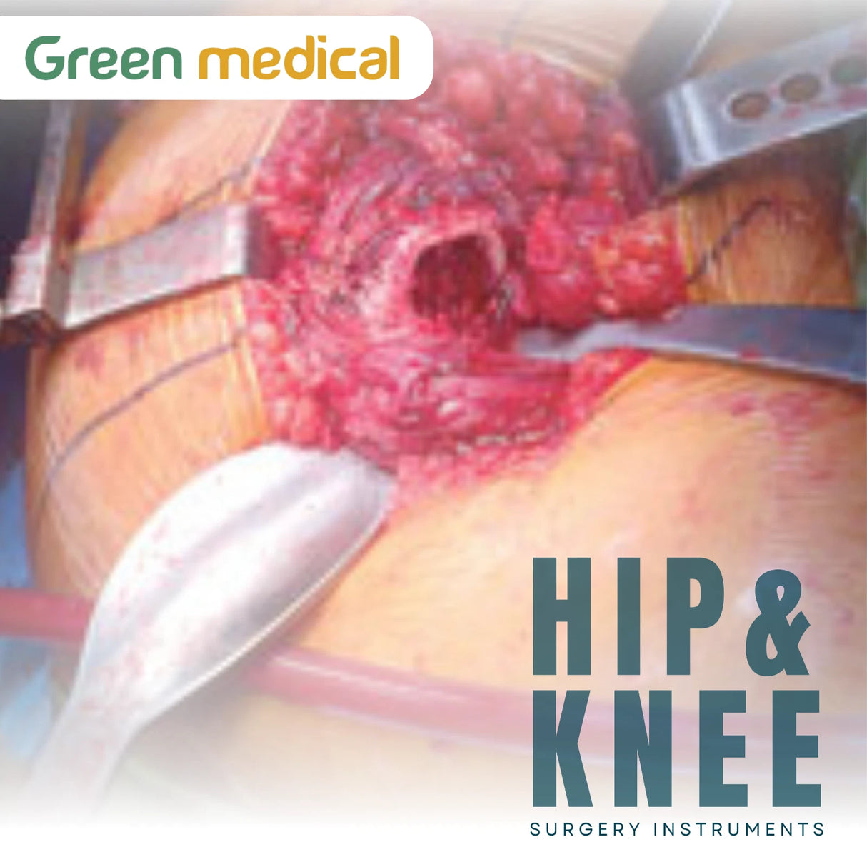 Harwin Modified Cobra Retractor Orthopedic Spine Surgical Instrument Stainless