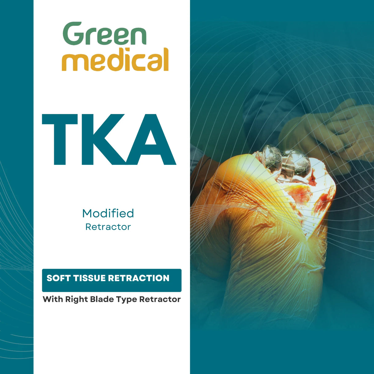 Right Modified TKA Retractor-Orthopedic Knee Surgery Instrument Stainless Steel