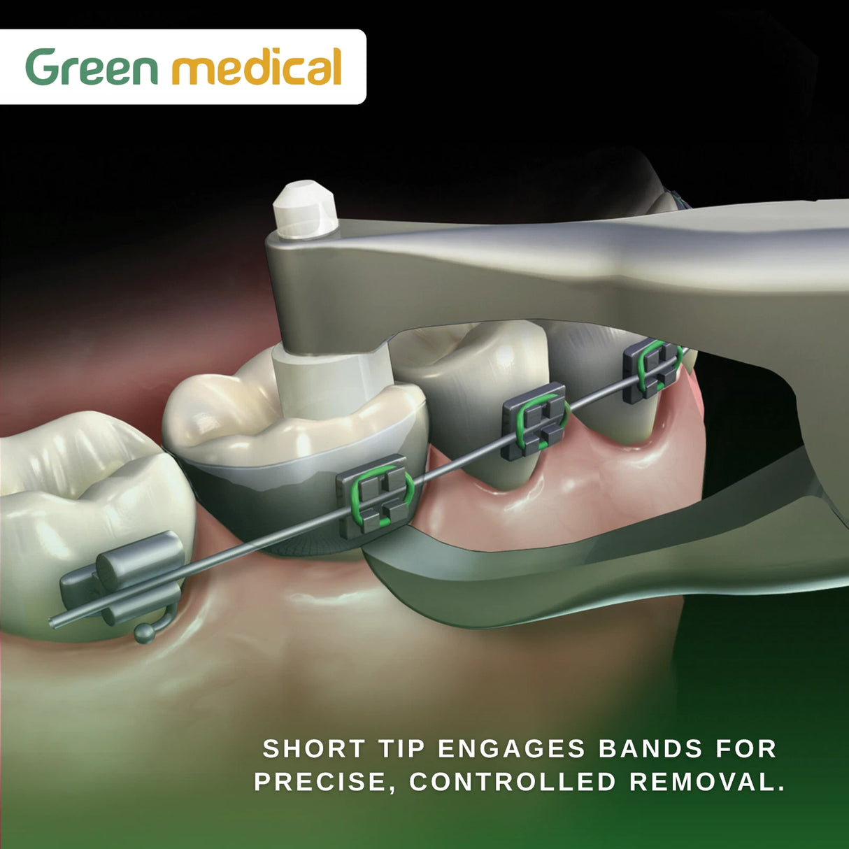 Bracket Removing Short Posterior Adhesive Band Remover Orthodontic Dental Pliers