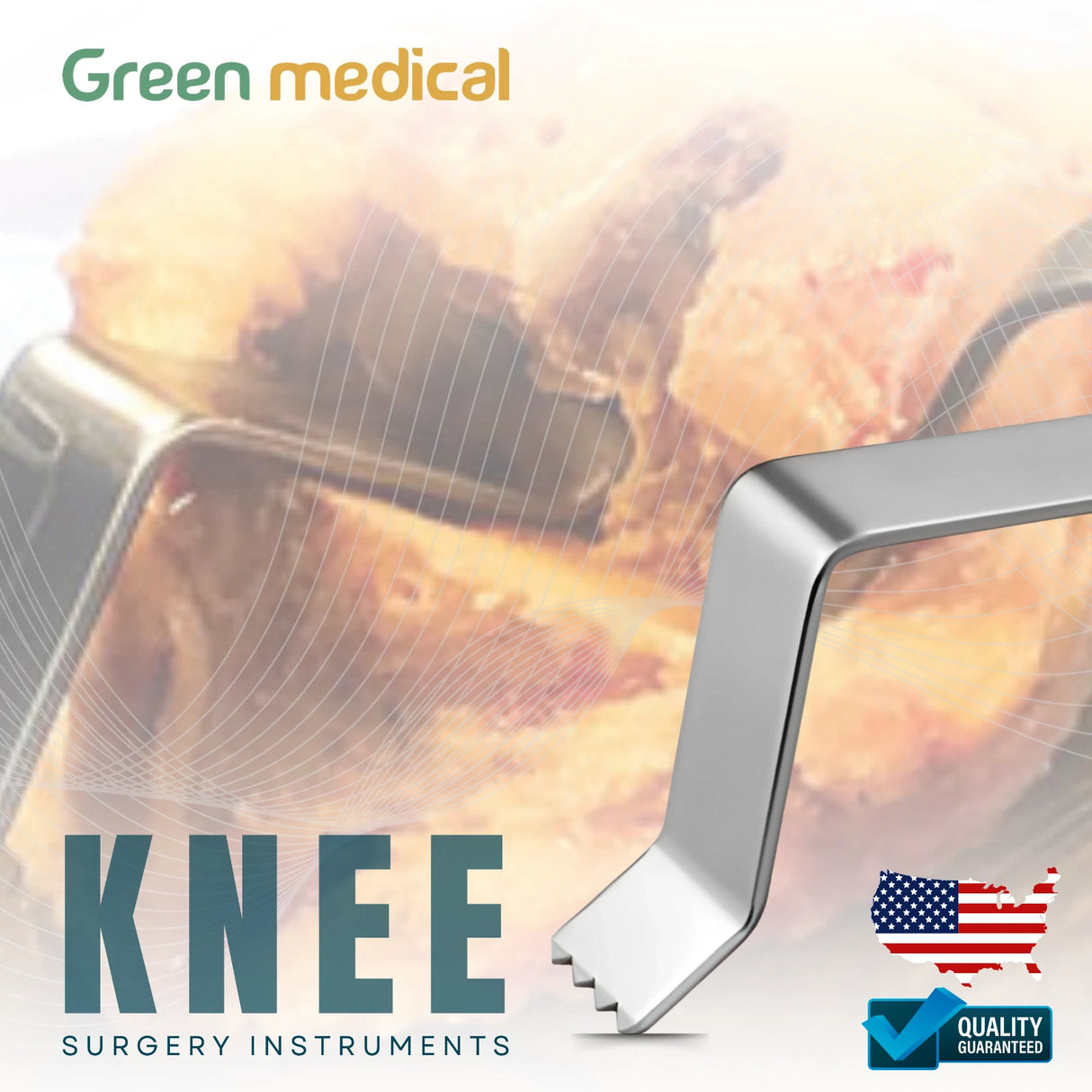 Glassman Posterior Condylar Osteophyte Retractor Orthopedic Surgical Tool