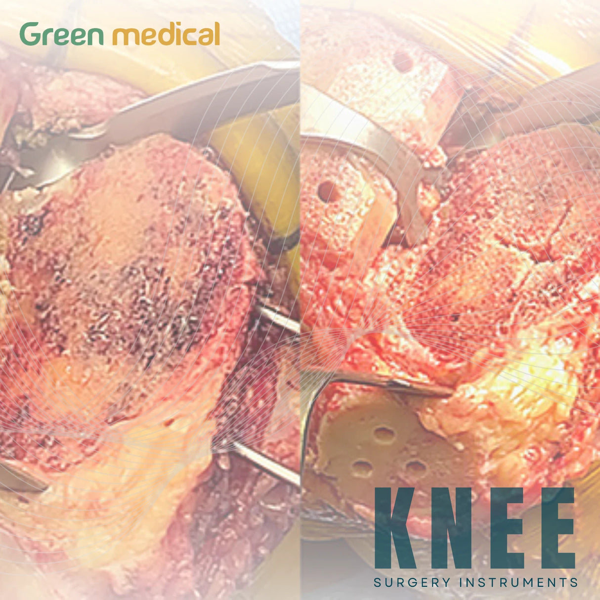 Teurlings Modified Bent Hohmann Retractor Orthopedic Surgical Instrument