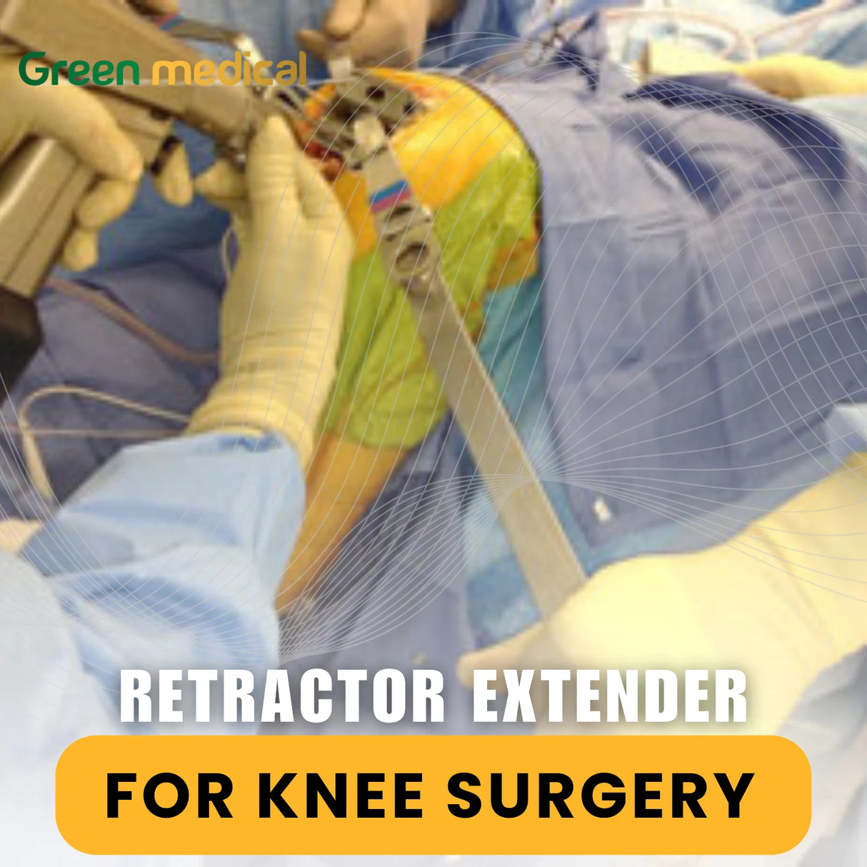 Pherson Mc Retractor Extender Surgical Instrument for Ophthalmic Procedures