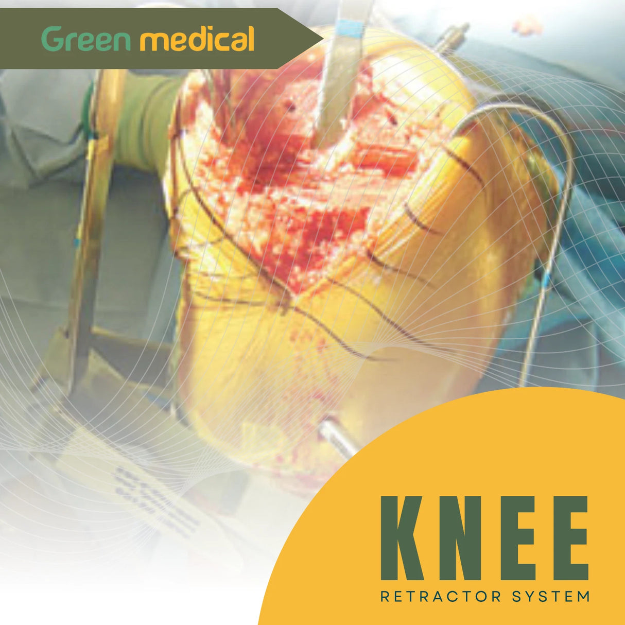 Collateral Ligament Retractor – Long Prong Orthopedic Surgical Instrument