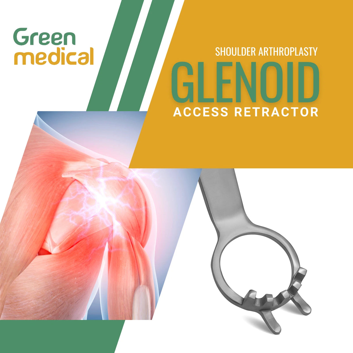 Glenoid Access Retractor Shoulder Surgery Orthopedic Instrument German Grade
