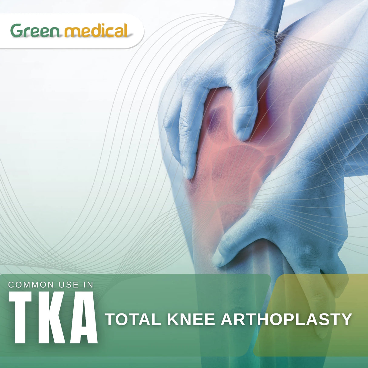 Medical illustration of a knee with gloved hands, labeled 'Green Medical' and 'Total Knee Arthroplasty'.