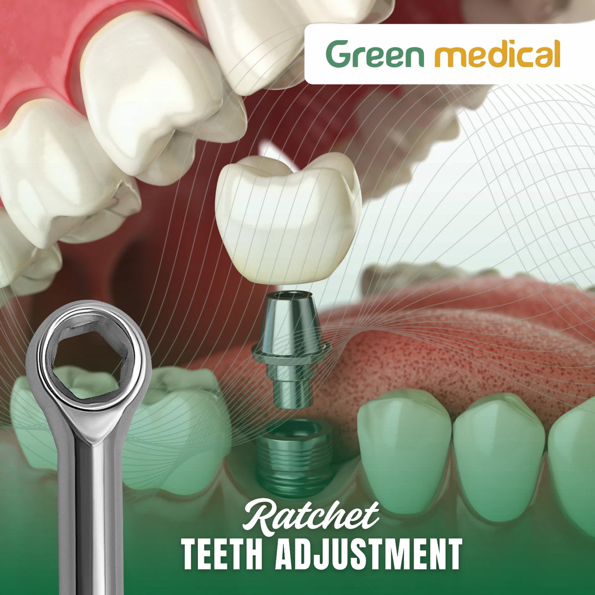 Dental Ratchet Wrench Hexagonal 6.35mm Handpiece Tool for Dental Procedures