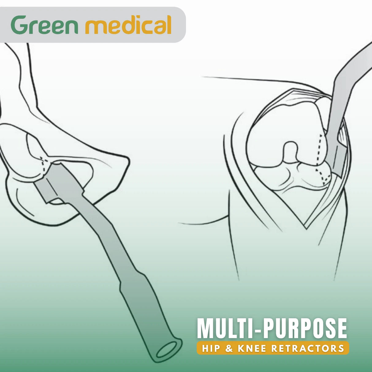 Surgical Retractors for Hip & Knee – Multi-Purpose Orthopedic Instruments