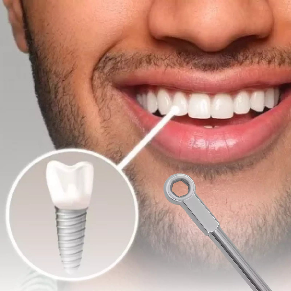 Ratchet Wrench Dental Implant 6.35mm Hex Rachet Dental Instruments